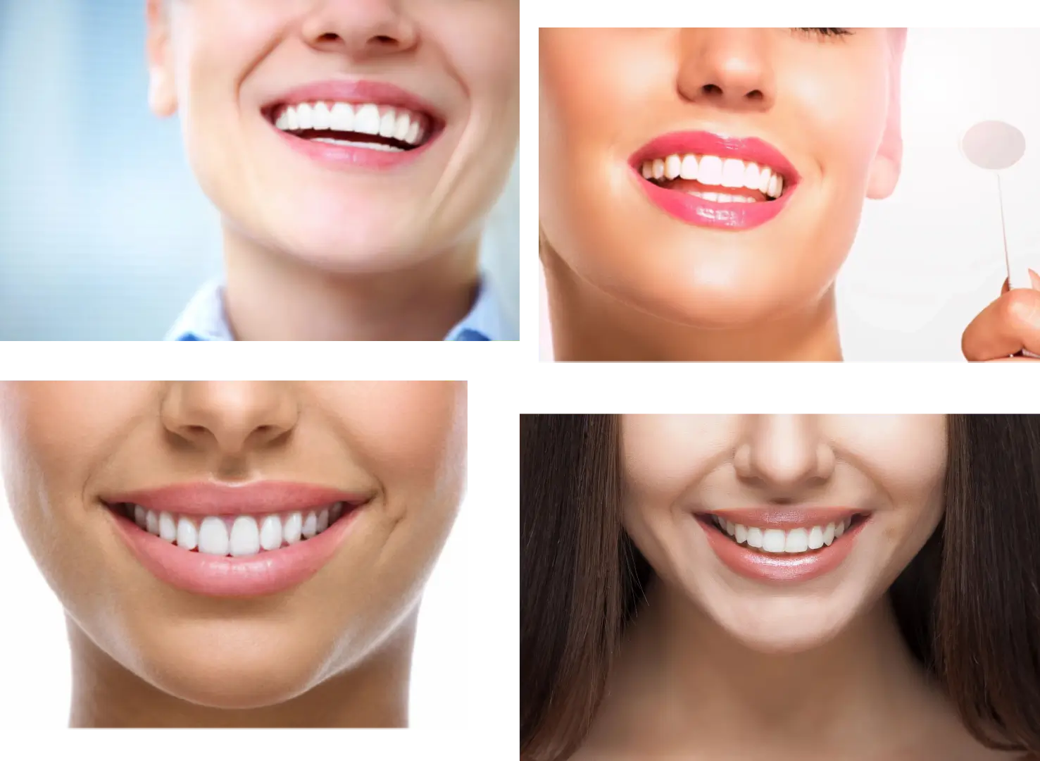 teeth in women