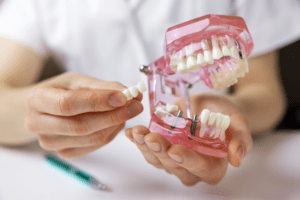 Person holding Multiple tooth implant model